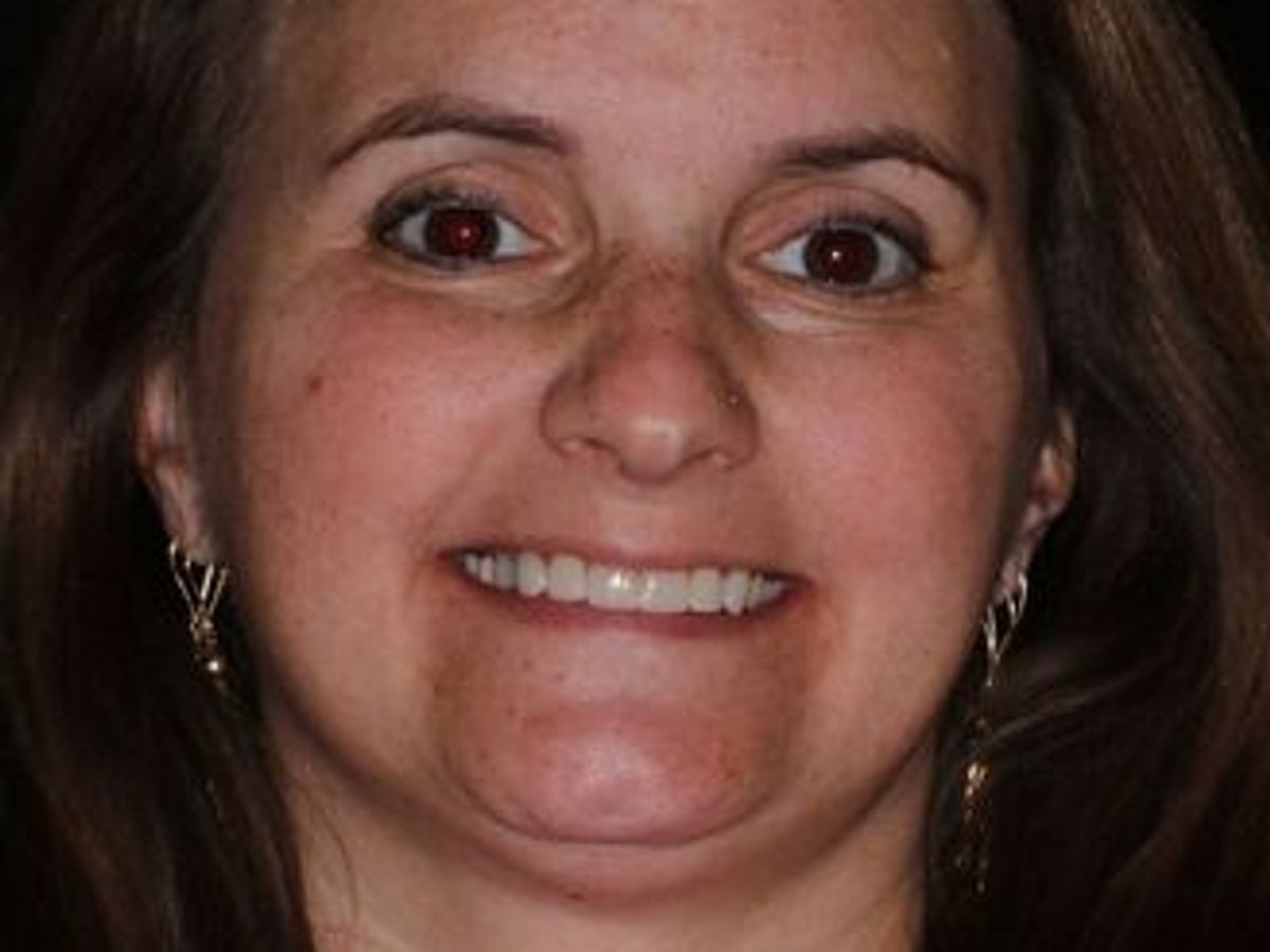 Veneers: Case 27 — after