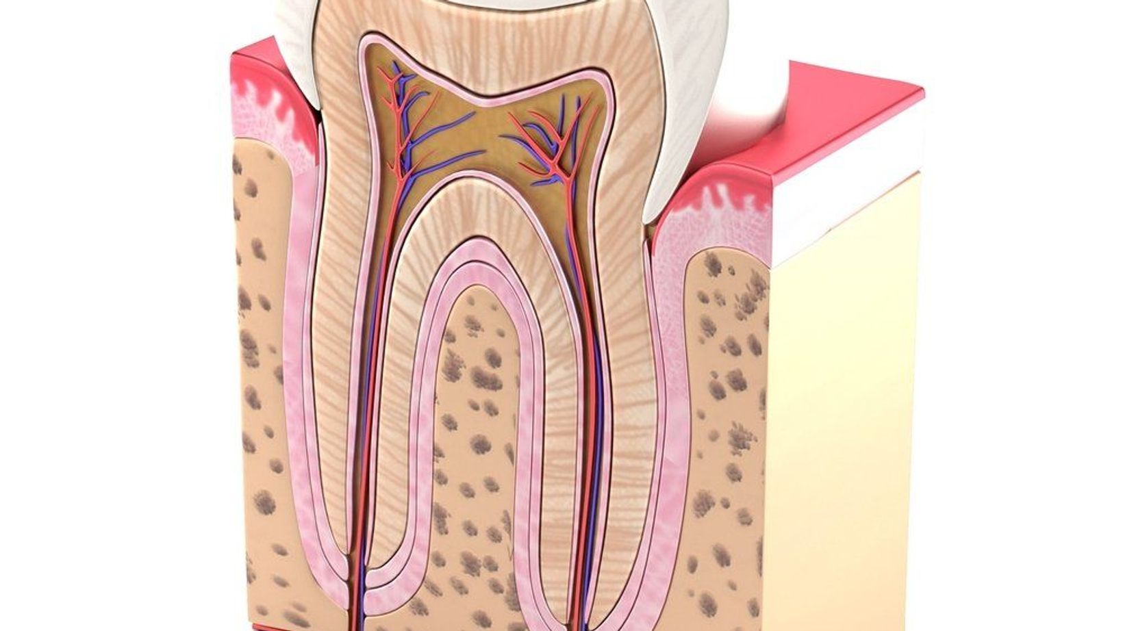 How Do Cavities Lead to Tooth Loss?