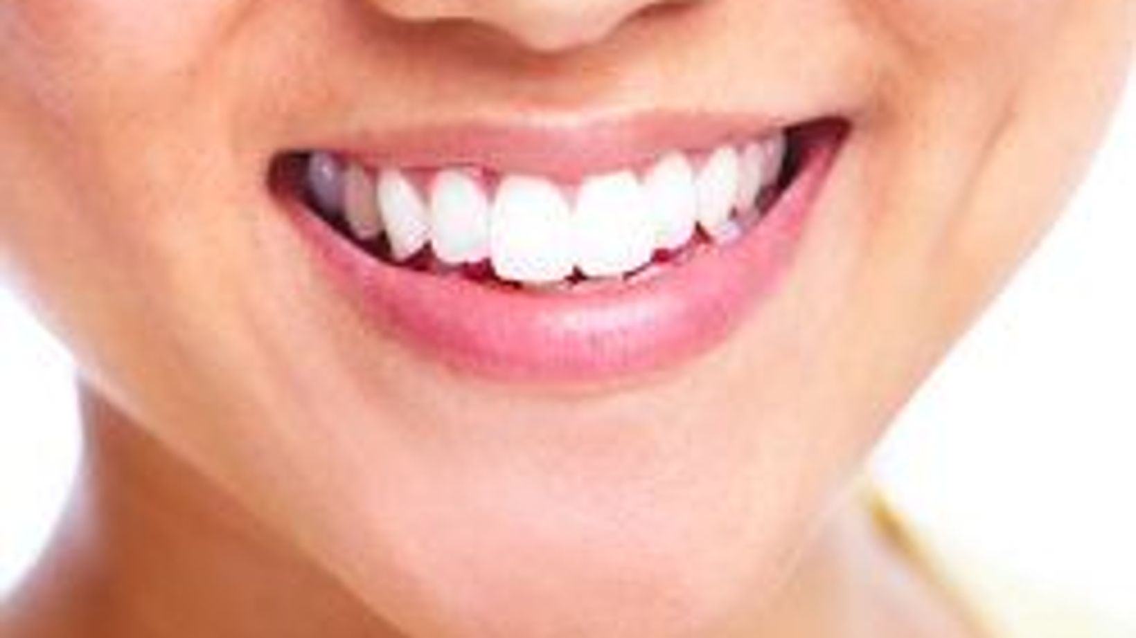 Applying Inlays and Onlays to Strengthen the Teeth