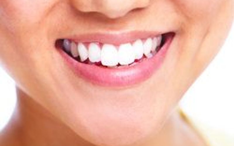 Applying Inlays and Onlays to Strengthen the Teeth