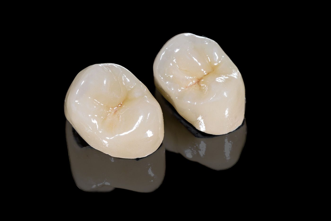 What Are the Benefits of Same-Day Crowns?