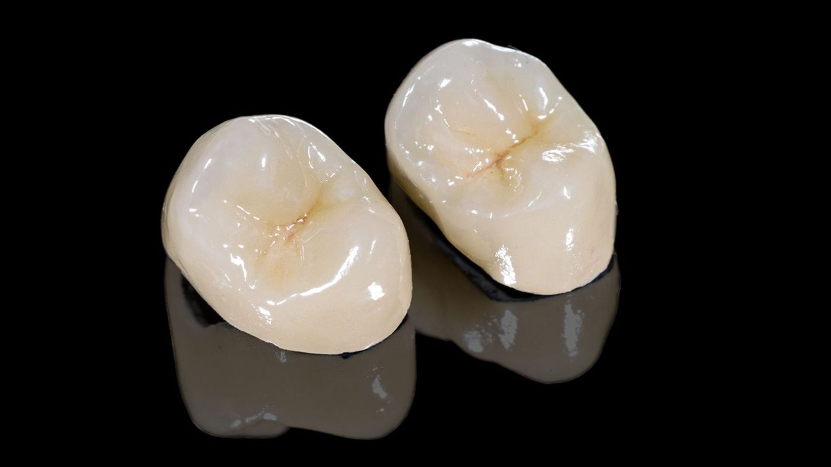 What Are the Benefits of Same-Day Crowns?