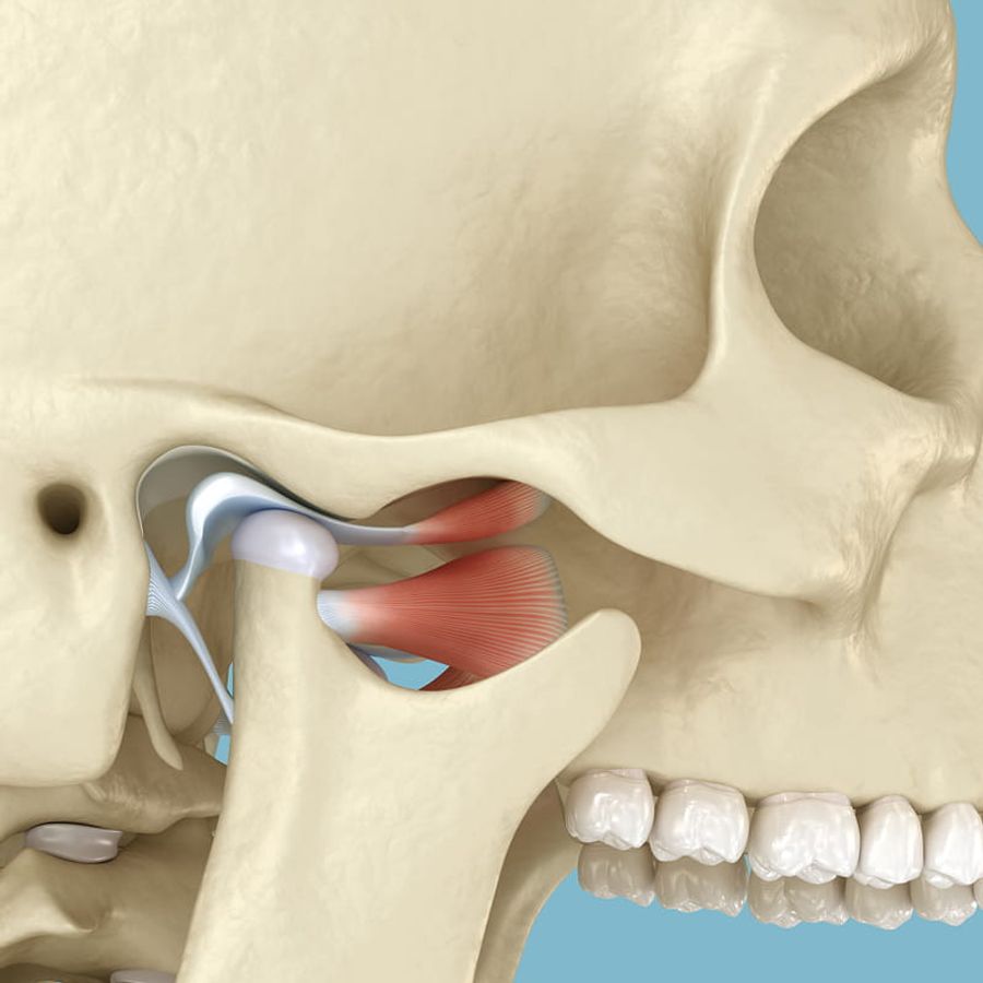 TMJ Treatments