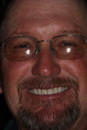 Veneers: Case 26 — after