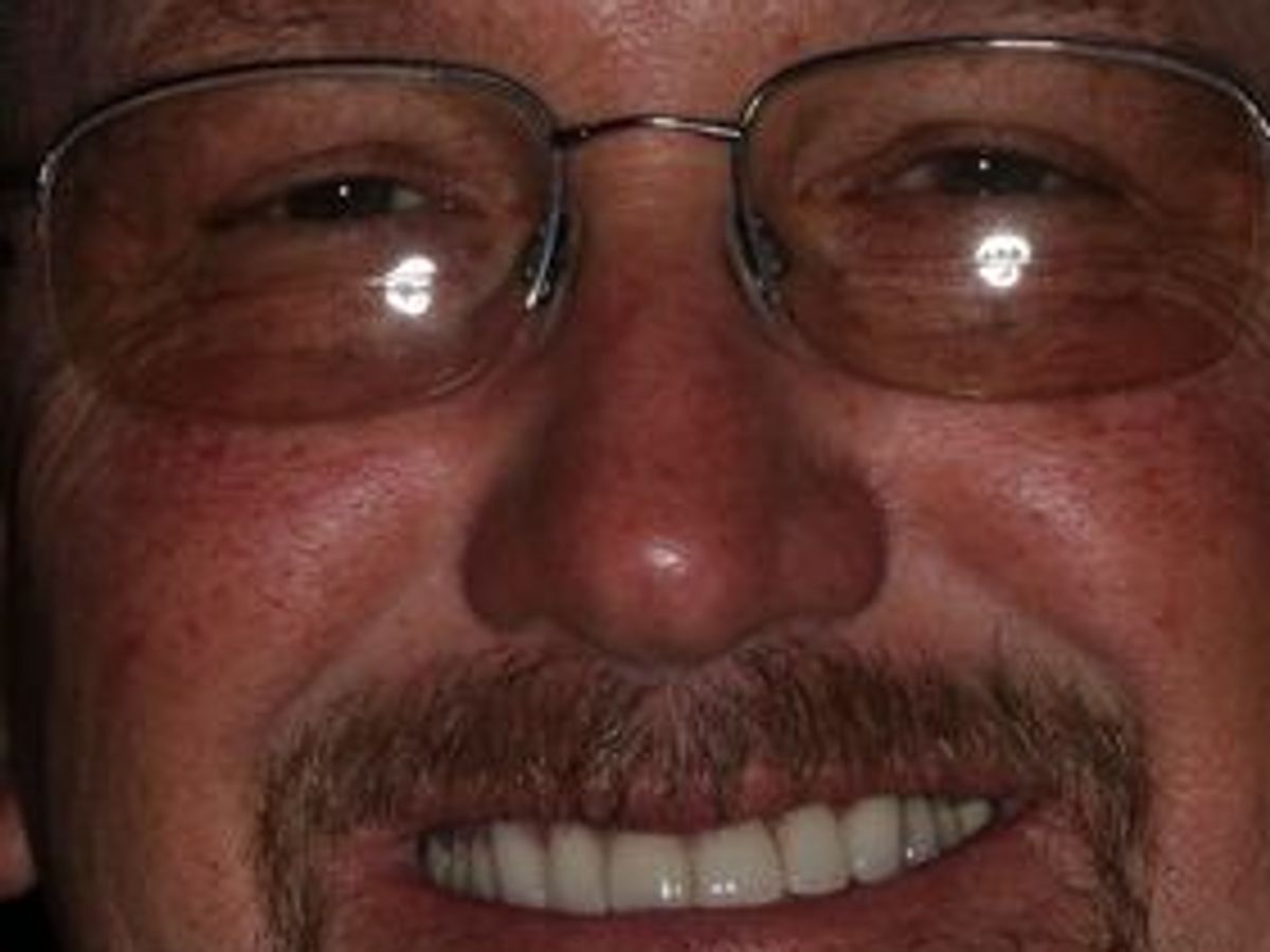 Veneers: Case 26 — after