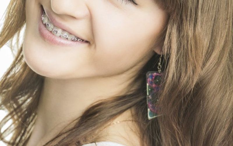 Keeping Teen Smiles Healthy
