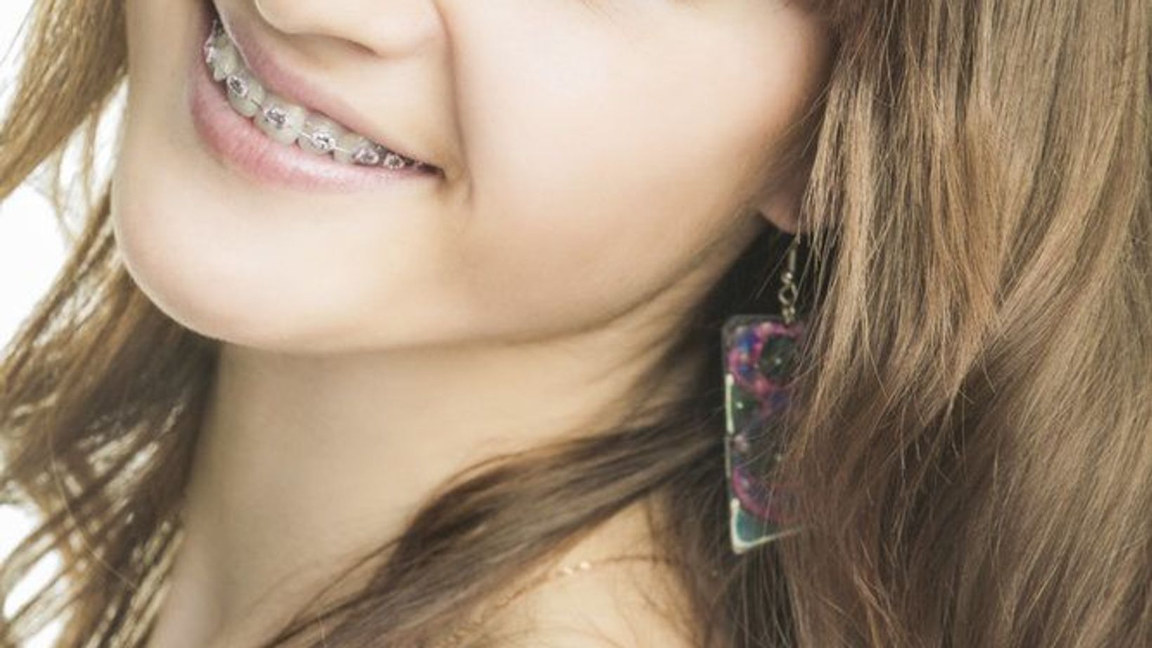Keeping Teen Smiles Healthy