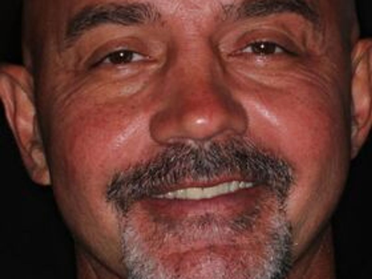 Veneers: Case 28 — before