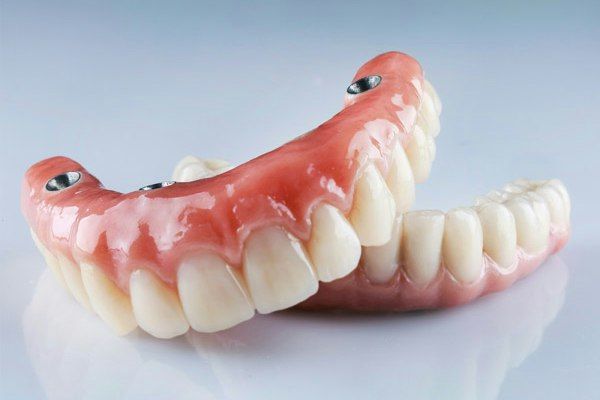 All on 4 dental implant denture with black background