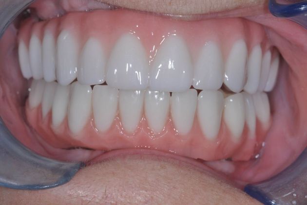 Teeth in a Day: Case 8 — after
