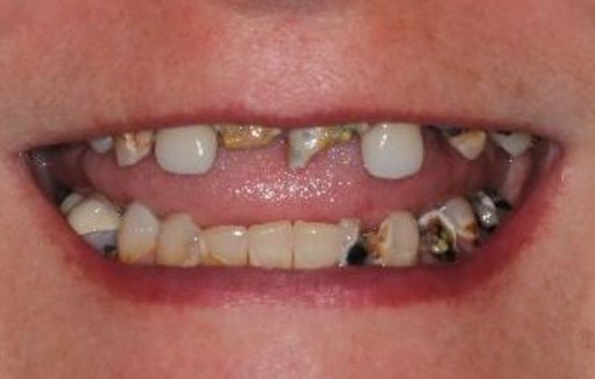 Teeth in a Day: Case 22 — before