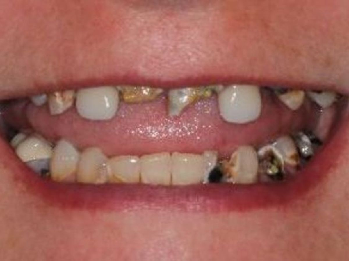 Teeth in a Day: Case 22 — before