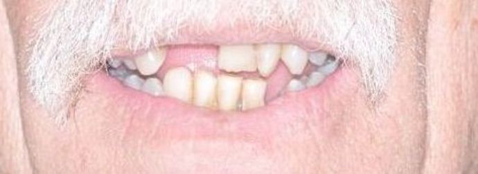 Teeth in a Day: Case 17 — before