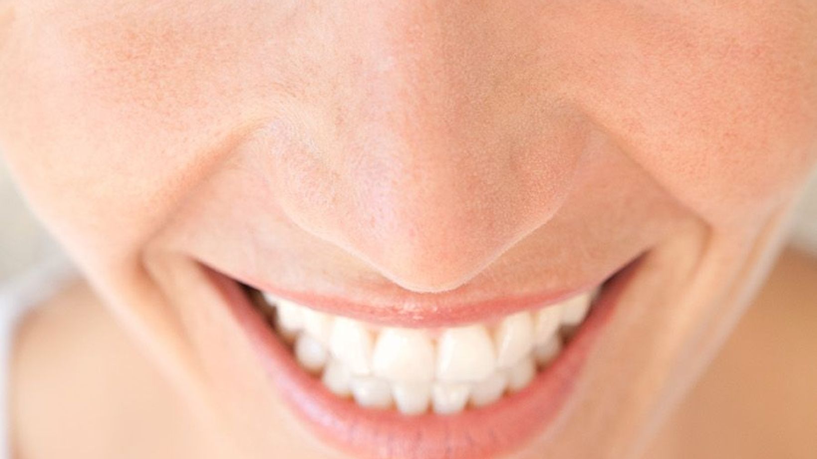 Treatments for Teeth That Overlap