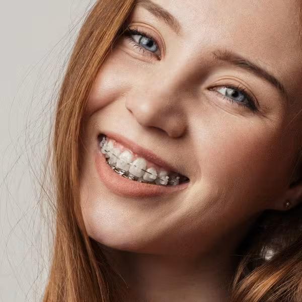 woman with traditional braces
