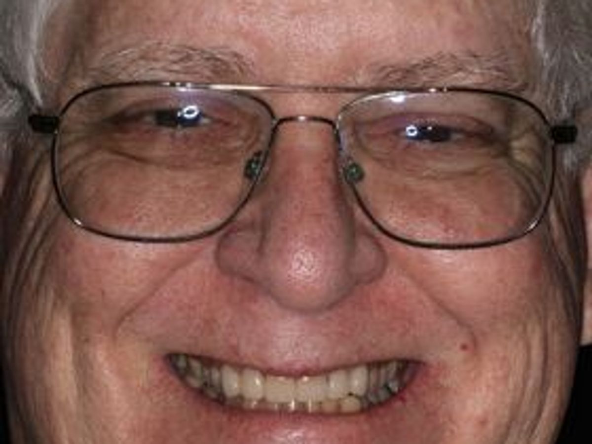 Veneers: Case 33 — after