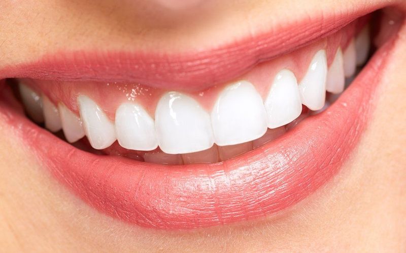 Treatment Options for Chipped Teeth