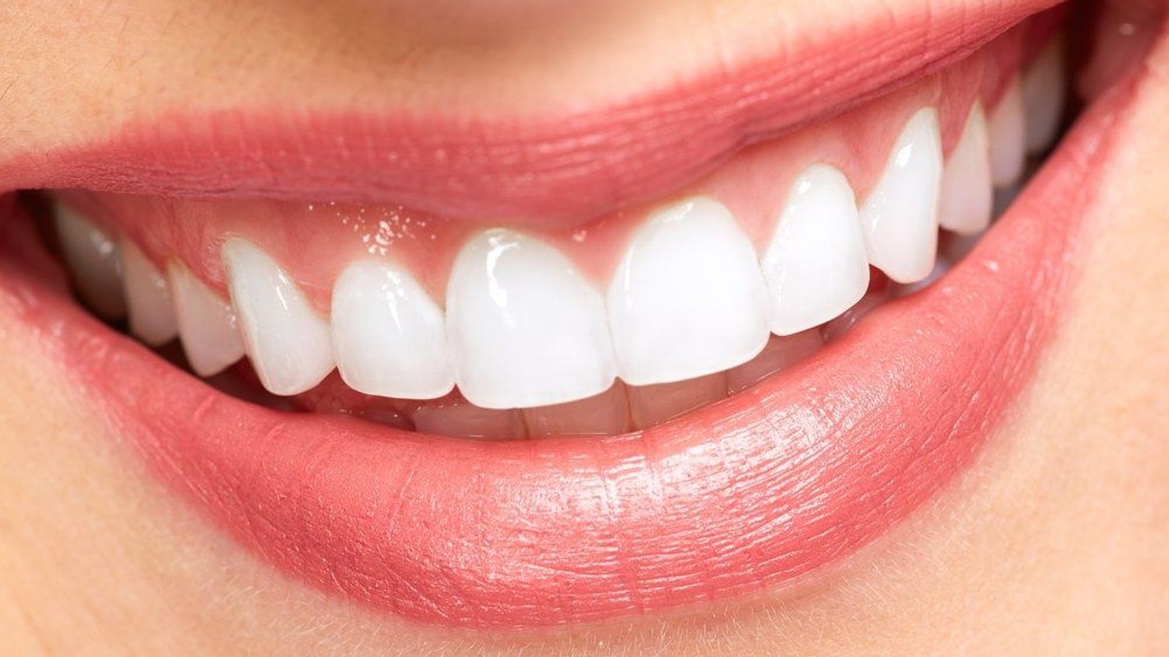 Treatment Options for Chipped Teeth