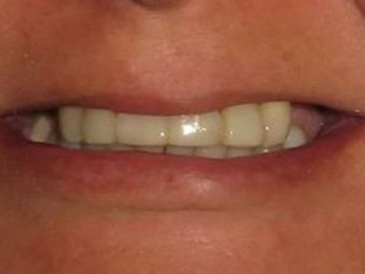 Teeth in a Day: Case 18 — before
