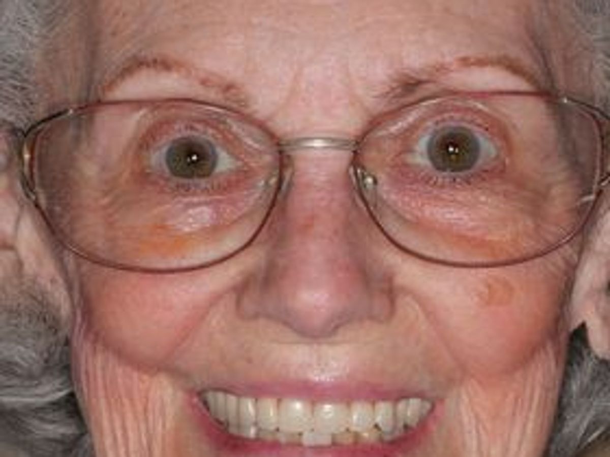 Dentures: Case 12 — after