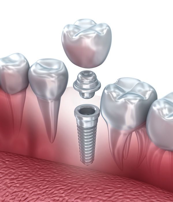 Preventing Tooth Loss after Oral Injury