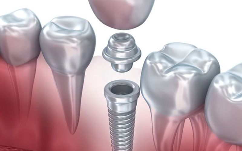 Preventing Tooth Loss after Oral Injury