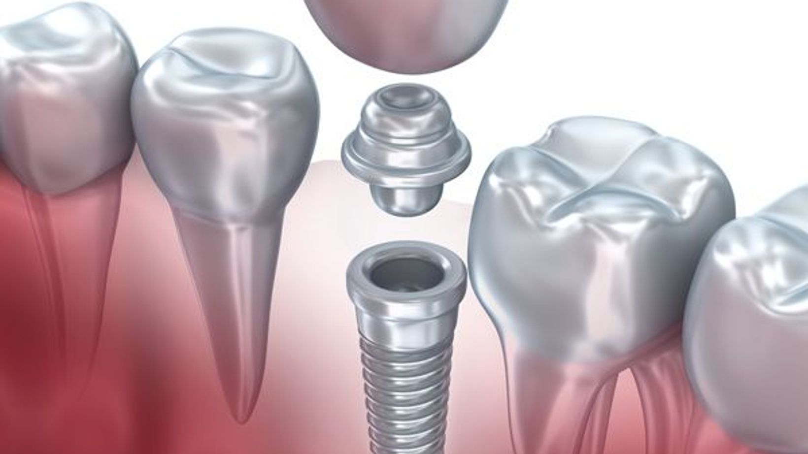 Preventing Tooth Loss after Oral Injury