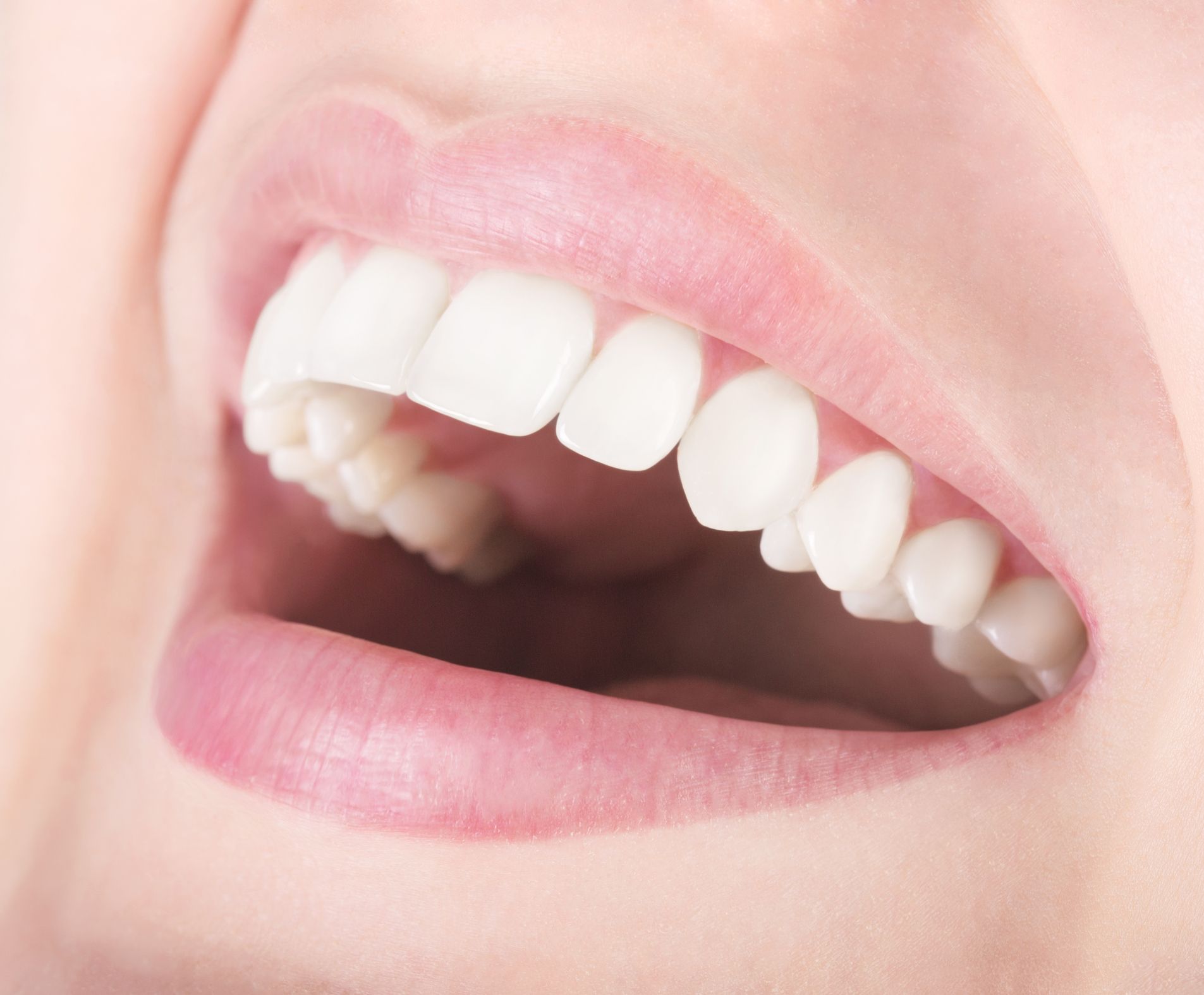 Whats the Difference between an Overbite and Overjet?
