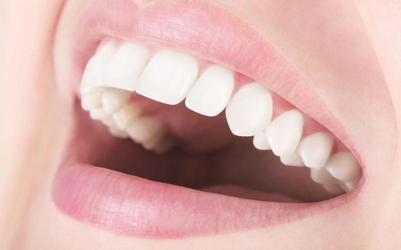 Whats the Difference between an Overbite and Overjet?