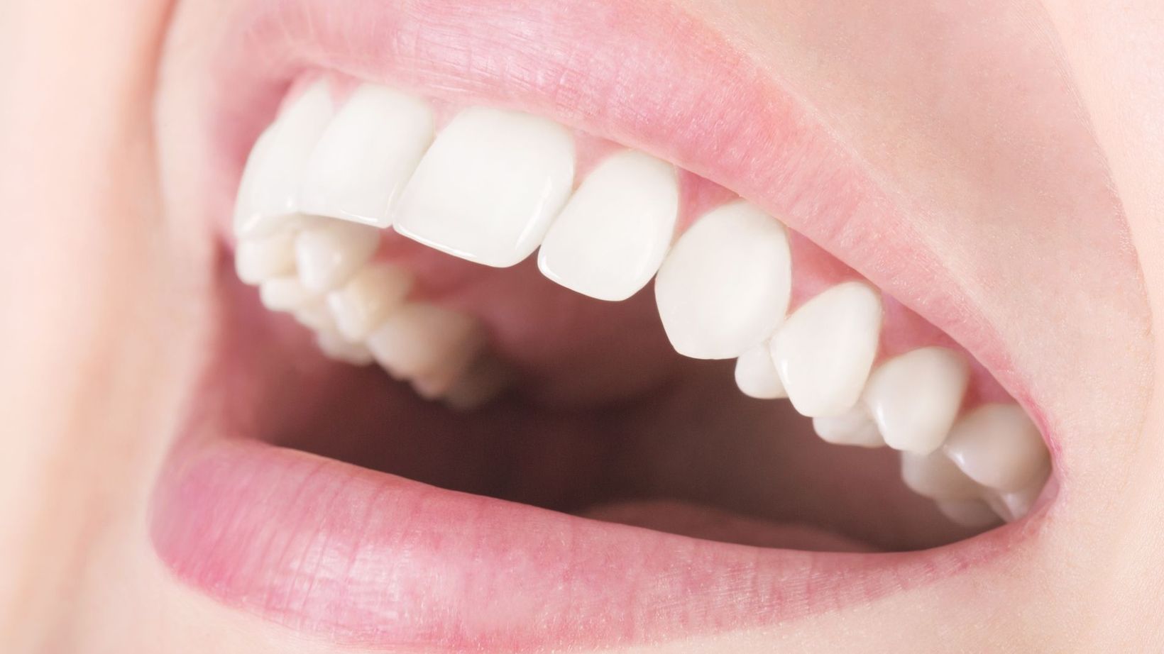 Whats the Difference between an Overbite and Overjet?