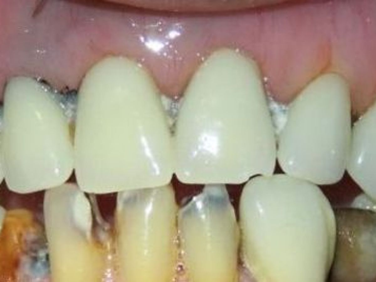 Teeth in a Day: Case 19 — before