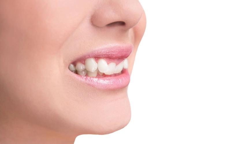 Treatment Options for a Jutted Tooth