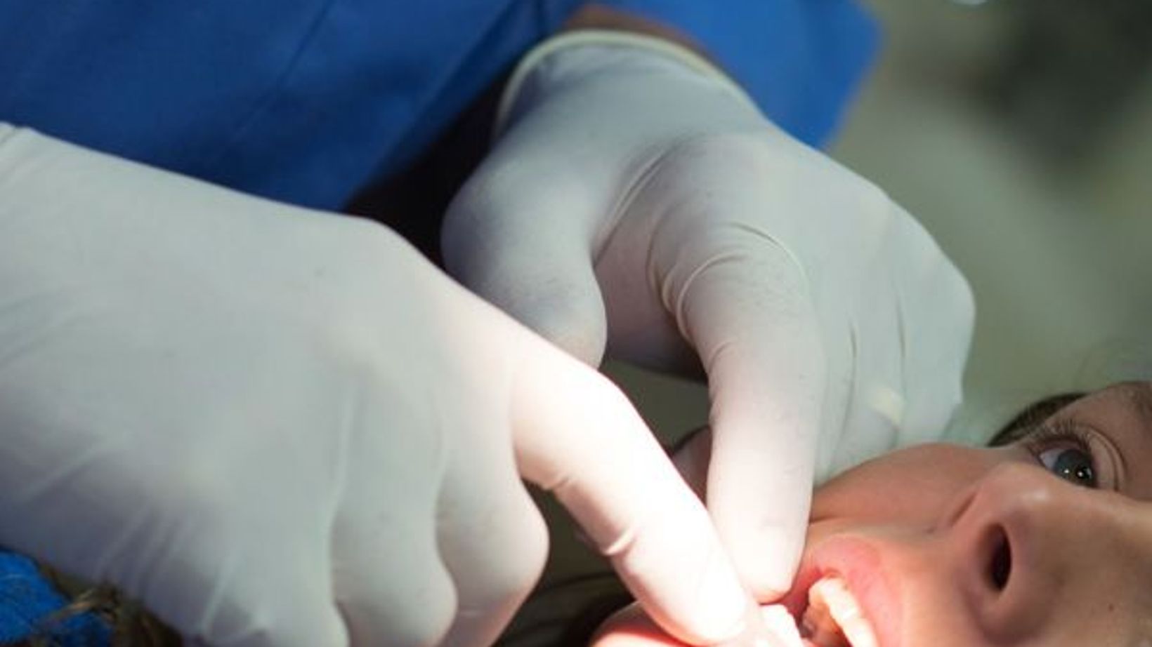 Treating the Most Common Causes of Tooth Erosion