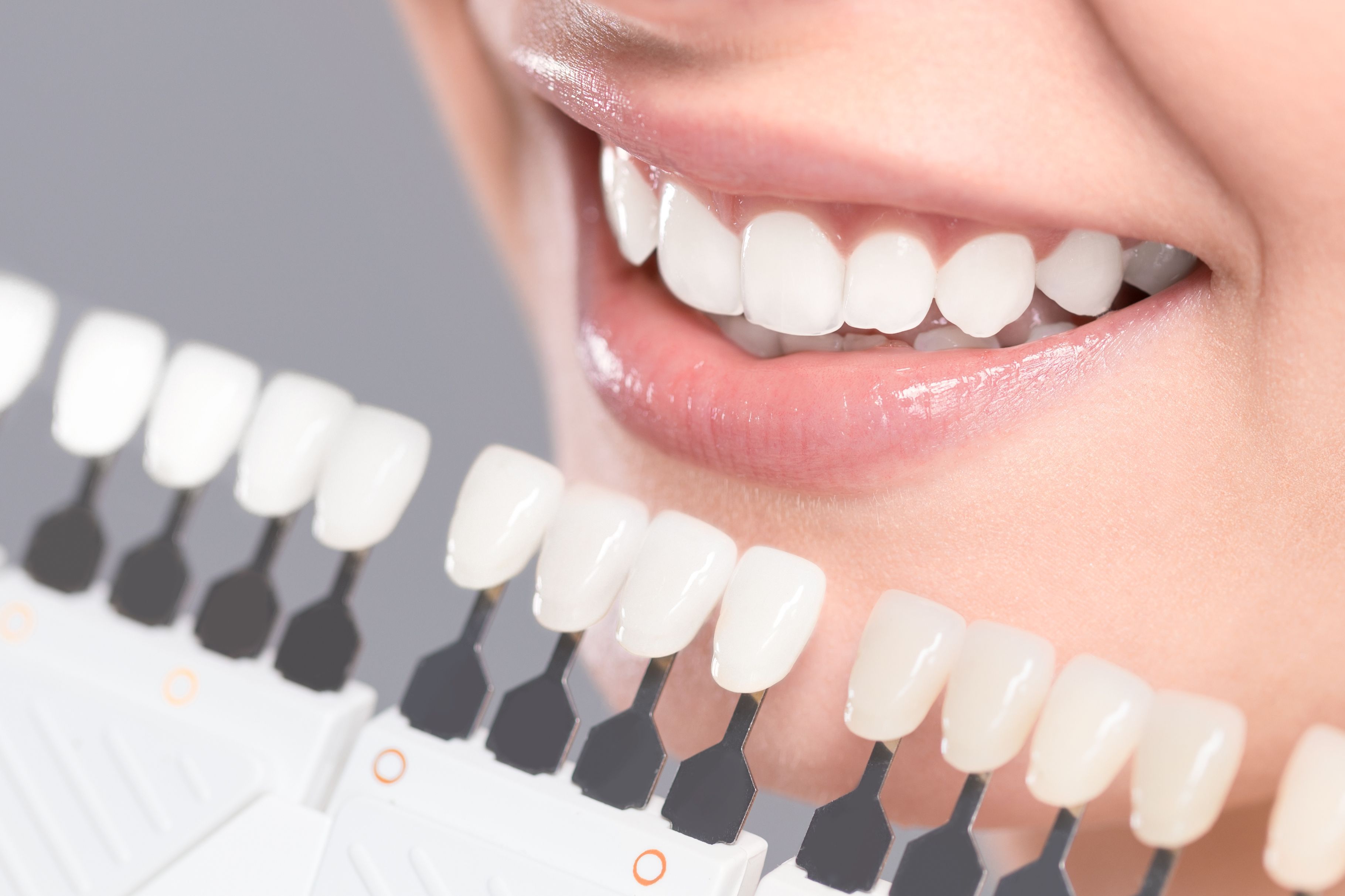 Brighten Your Smile with the KöR Teeth Whitening System