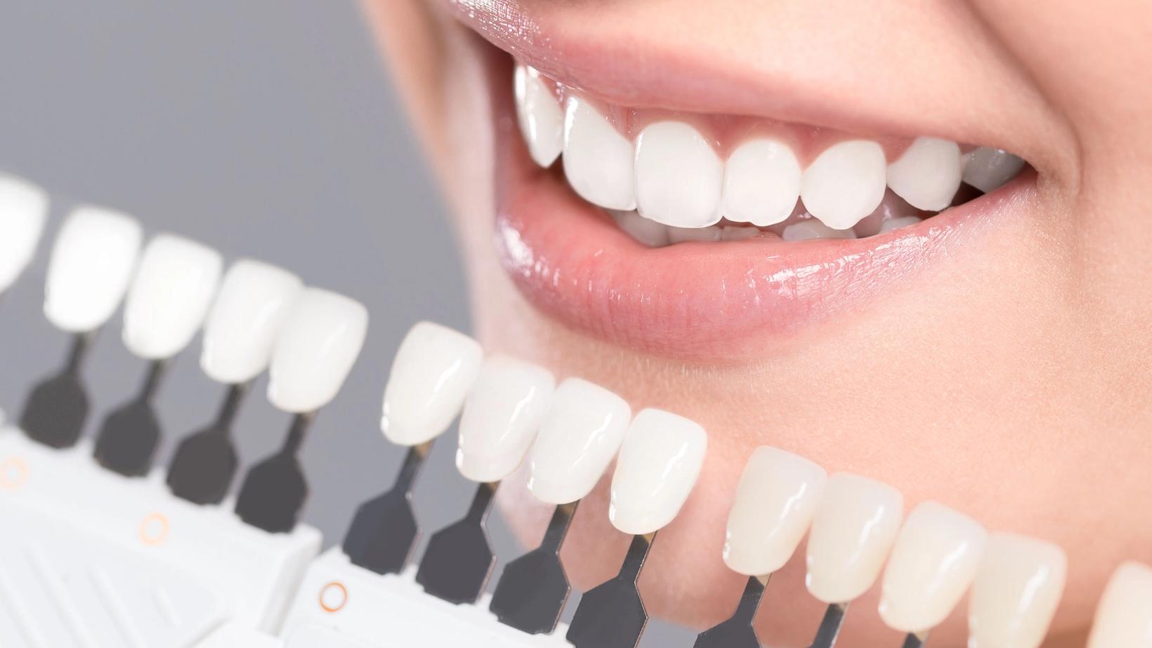 Brighten Your Smile with the KöR Teeth Whitening System