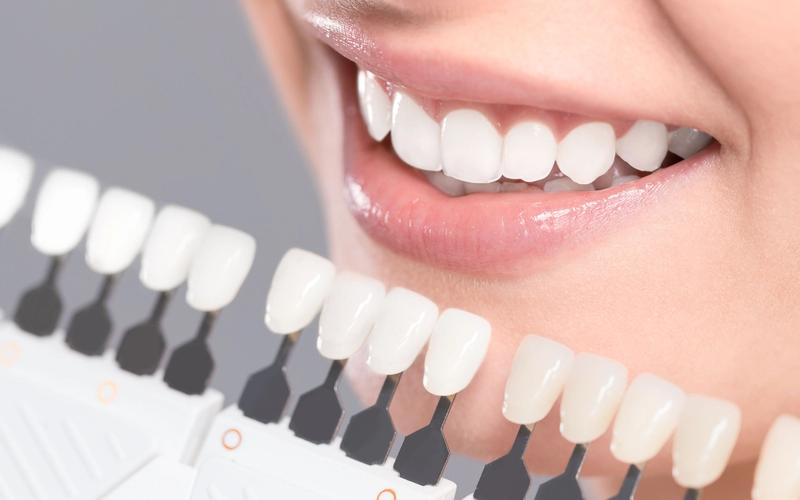 Brighten Your Smile with the KöR Teeth Whitening System