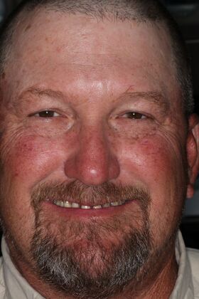 Veneers: Case 26 — before