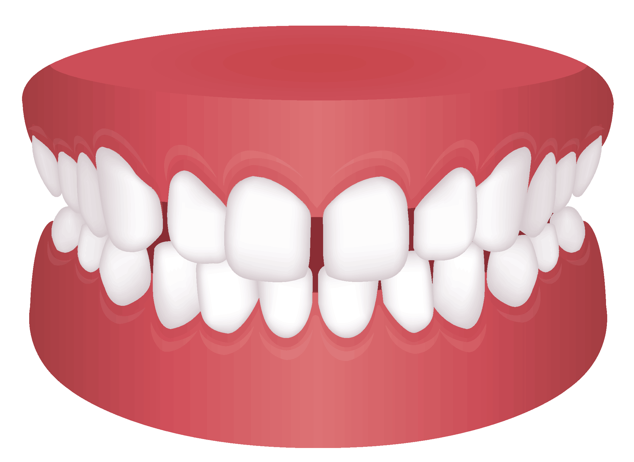 Gapped Teeth