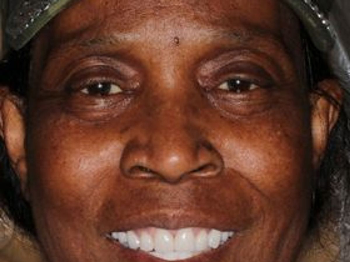 Veneers: Case 21 — after