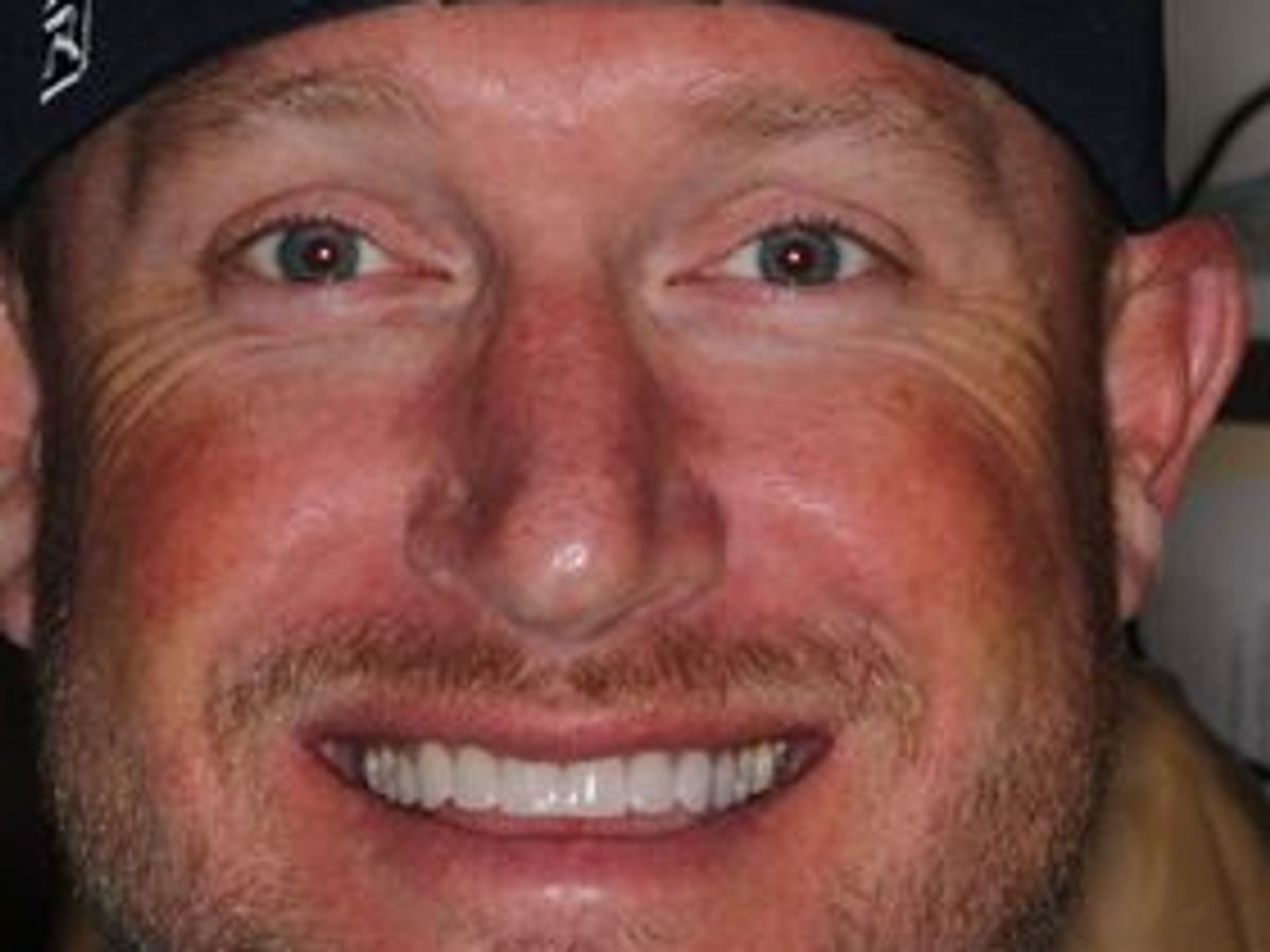 Veneers: Case 18 — after
