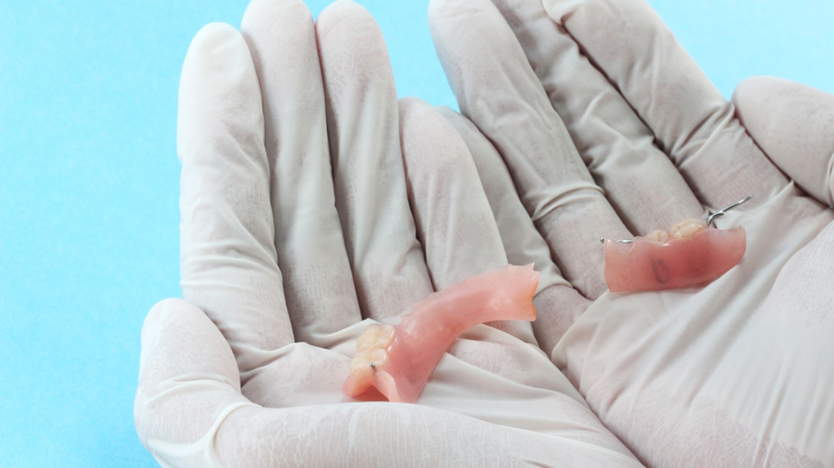 My Dentures Broke: What Should I Do?
