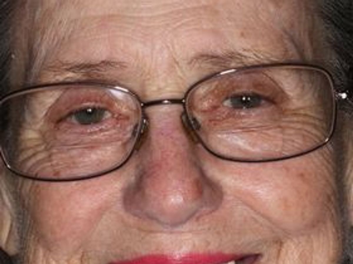 Dentures: Case 9 — before