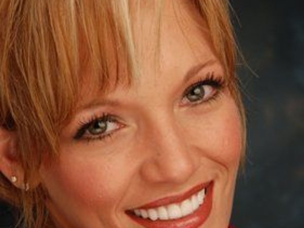 Veneers: Case 1 — after