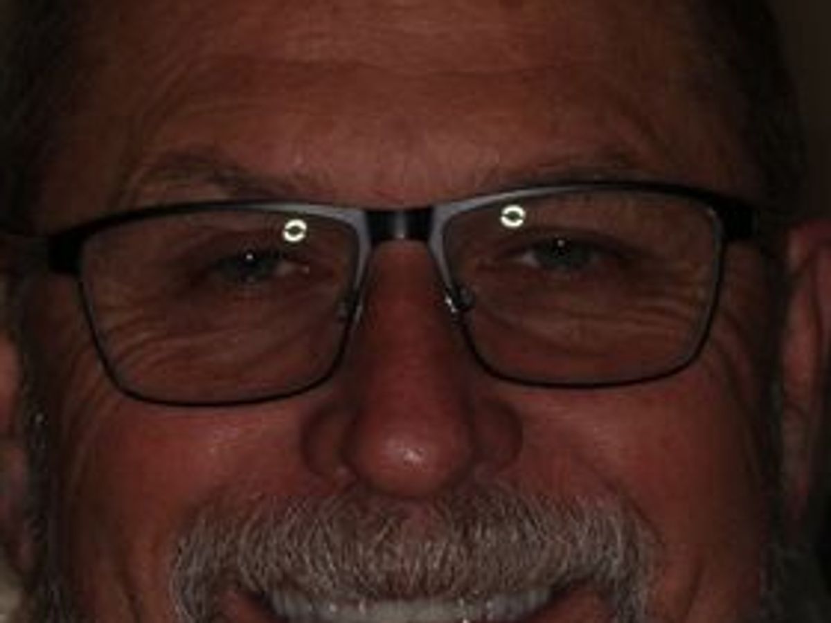 Full Mouth Reconstruction: Case 6 — after