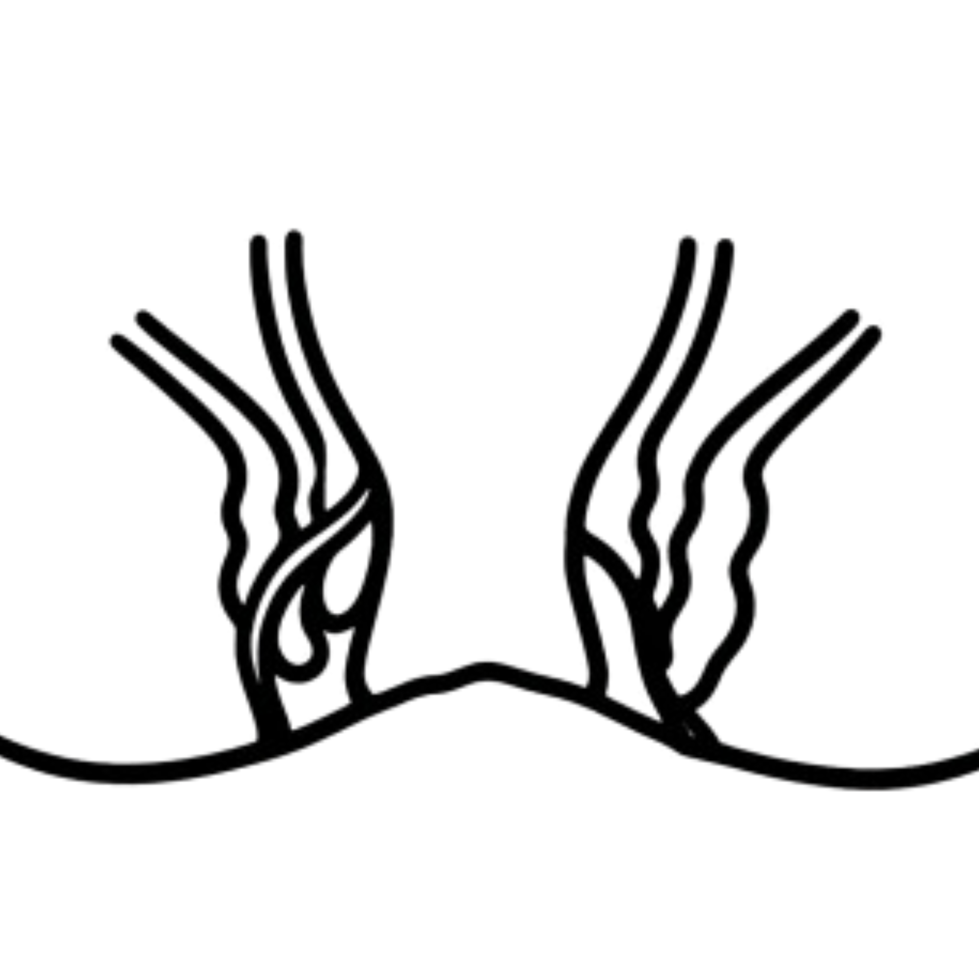 Anal Fistula