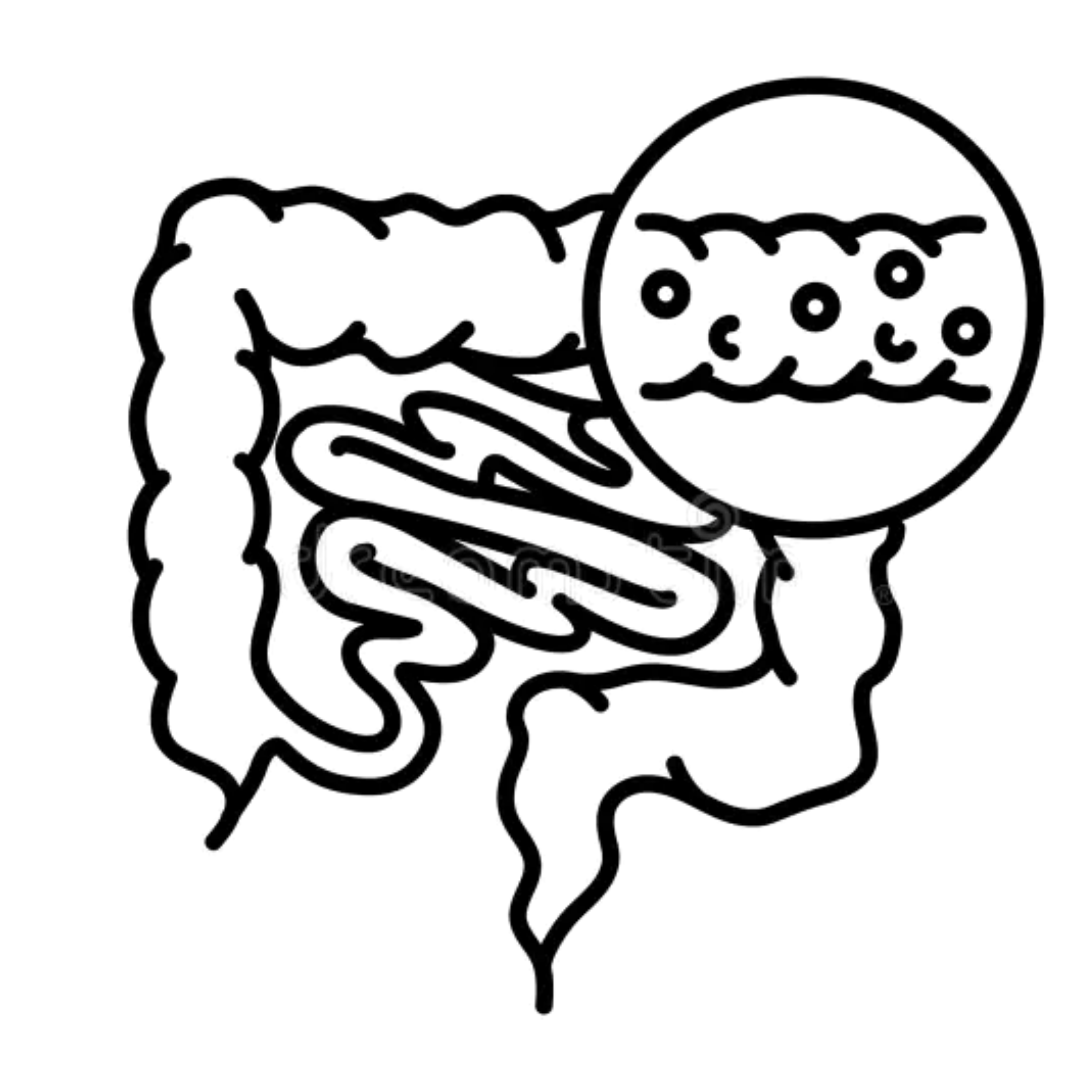 Ulcerative Colitis