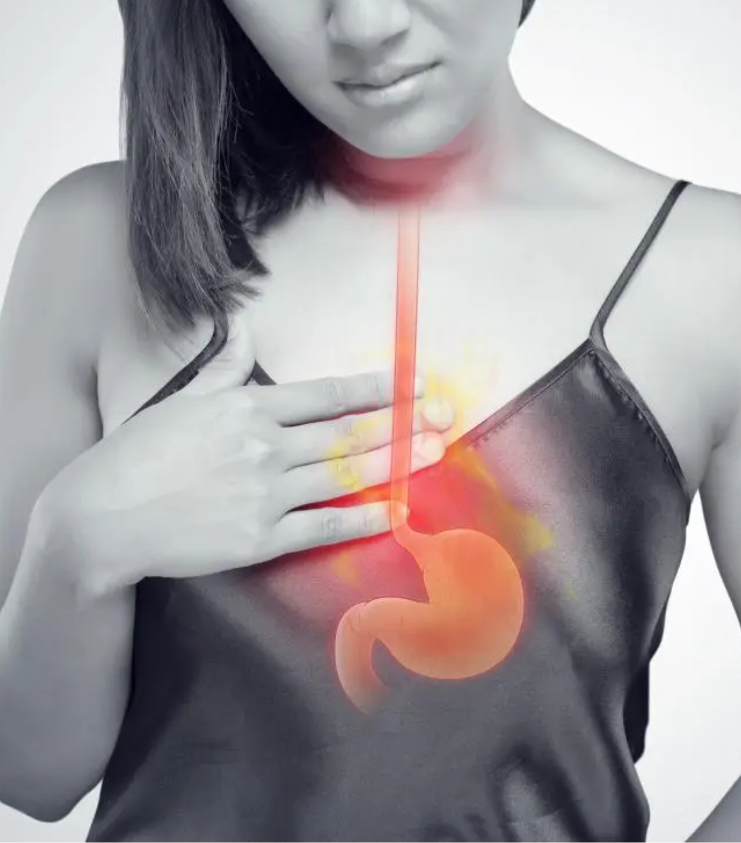Acid reflux GERD treatment by Dr. Tejasree laparoscopic surgeon Hyderabad