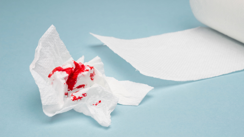 Bleeding During Motion