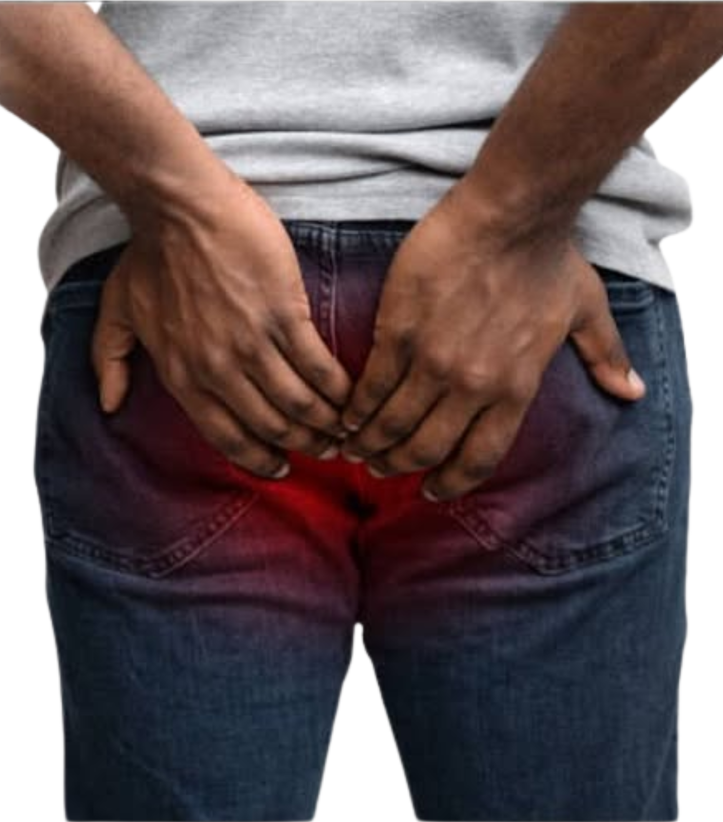 Rectal prolapse treatment by Dr Tejasree expert surgeon laparoscopic care