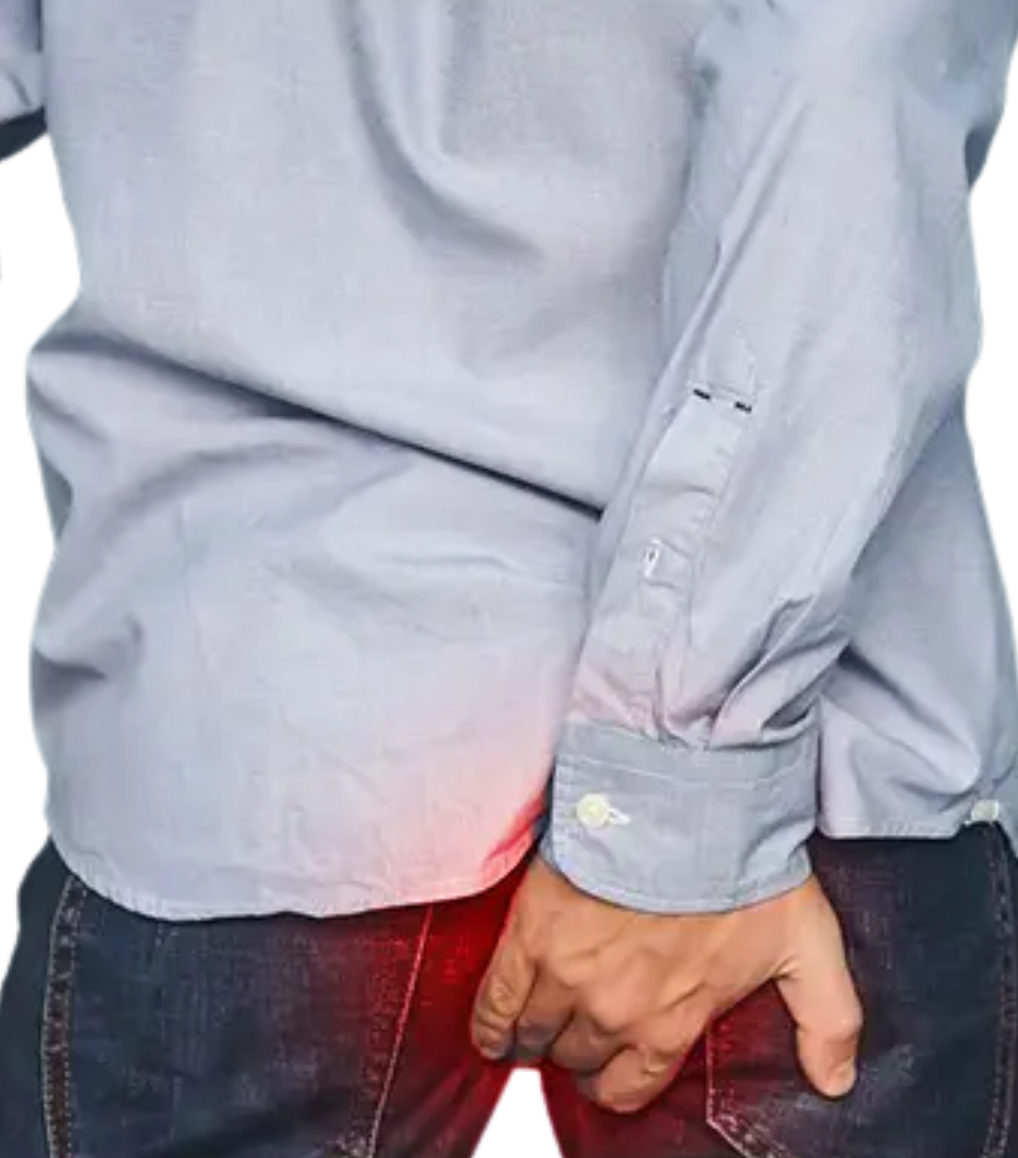 Pilonidal sinus treatment by Dr Tejasree minimally invasive surgery
